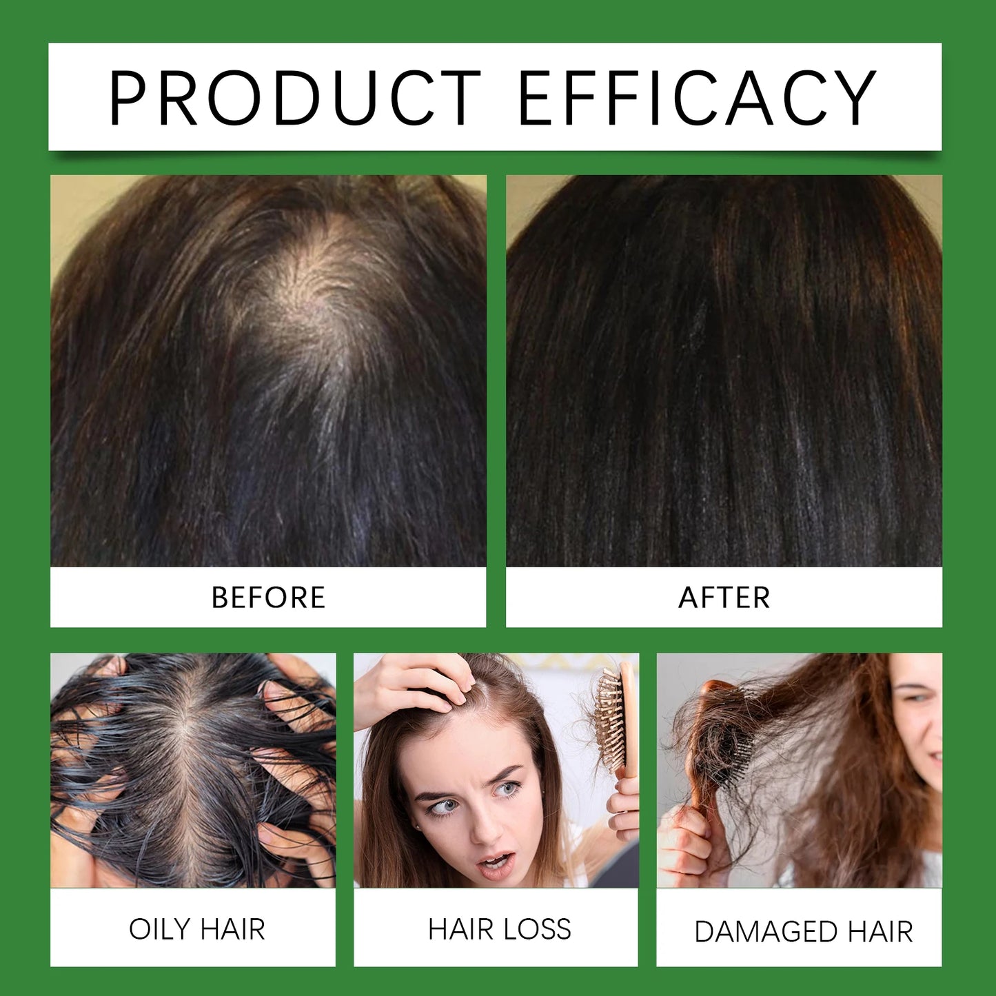 Rice Water & Rosemary Hair Growth Spray – Biotin & Peppermint Infused