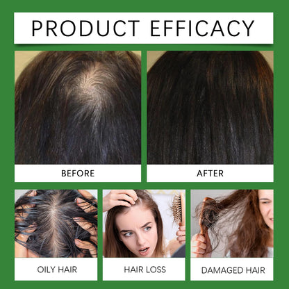 Rice Water & Rosemary Hair Growth Spray – Biotin & Peppermint Infused