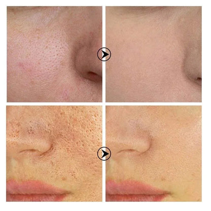Skin Texture Serum – Smoothing & Brightening Face Serum with Retinol & Niacinamide